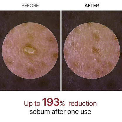 Dr. Melaxin Rice Peel Shot Ampoule™