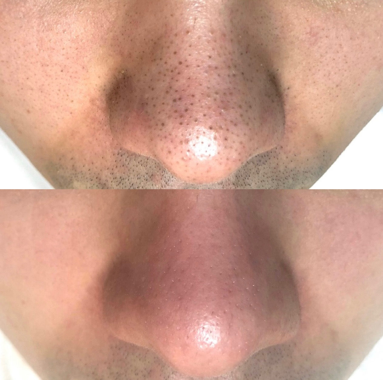 Dr. Melaxin Rice Peel Shot Ampoule™